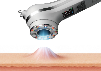 碧波庭5VS美容棒